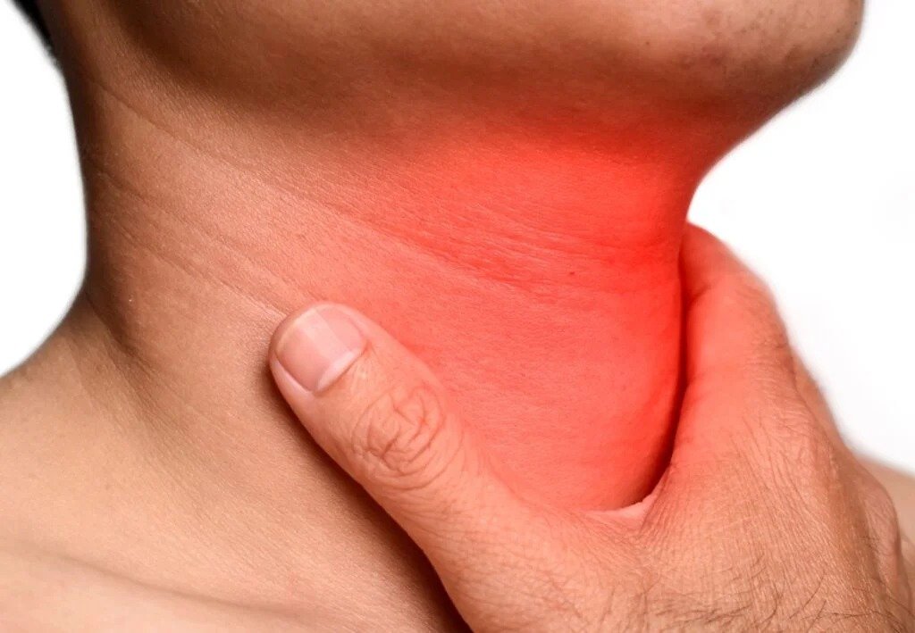 Descripción de la imagen